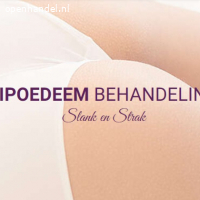 Lipoedeem Liposuctie Behandeling